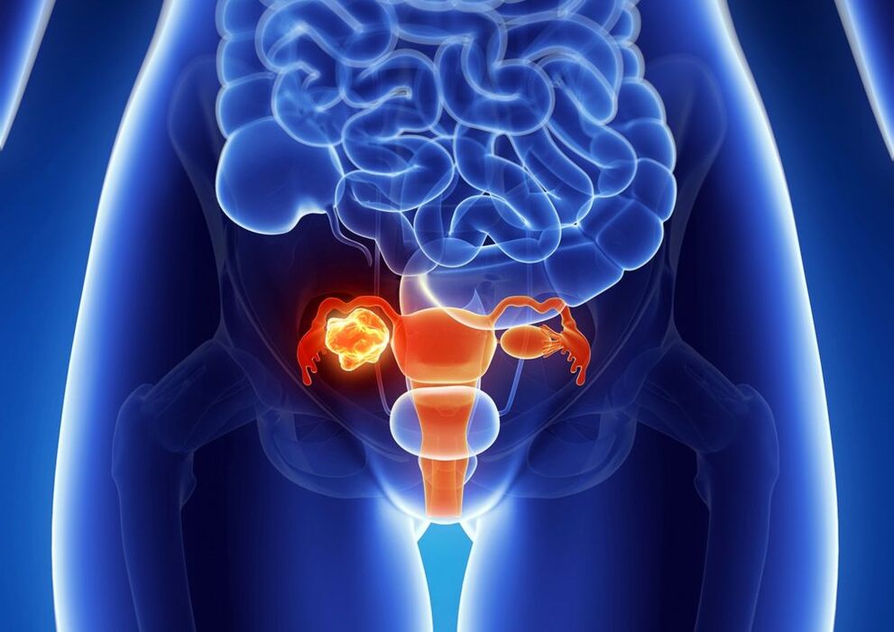 Women's pathology under the influence of alcohol